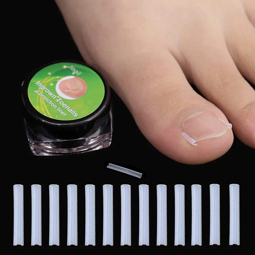 C-shaped Ingrown Toenail Corrector Ultra-thin Elastic Tube Pad Foot Care Toe Nails Treatment Straightening Clip Invisible Patch