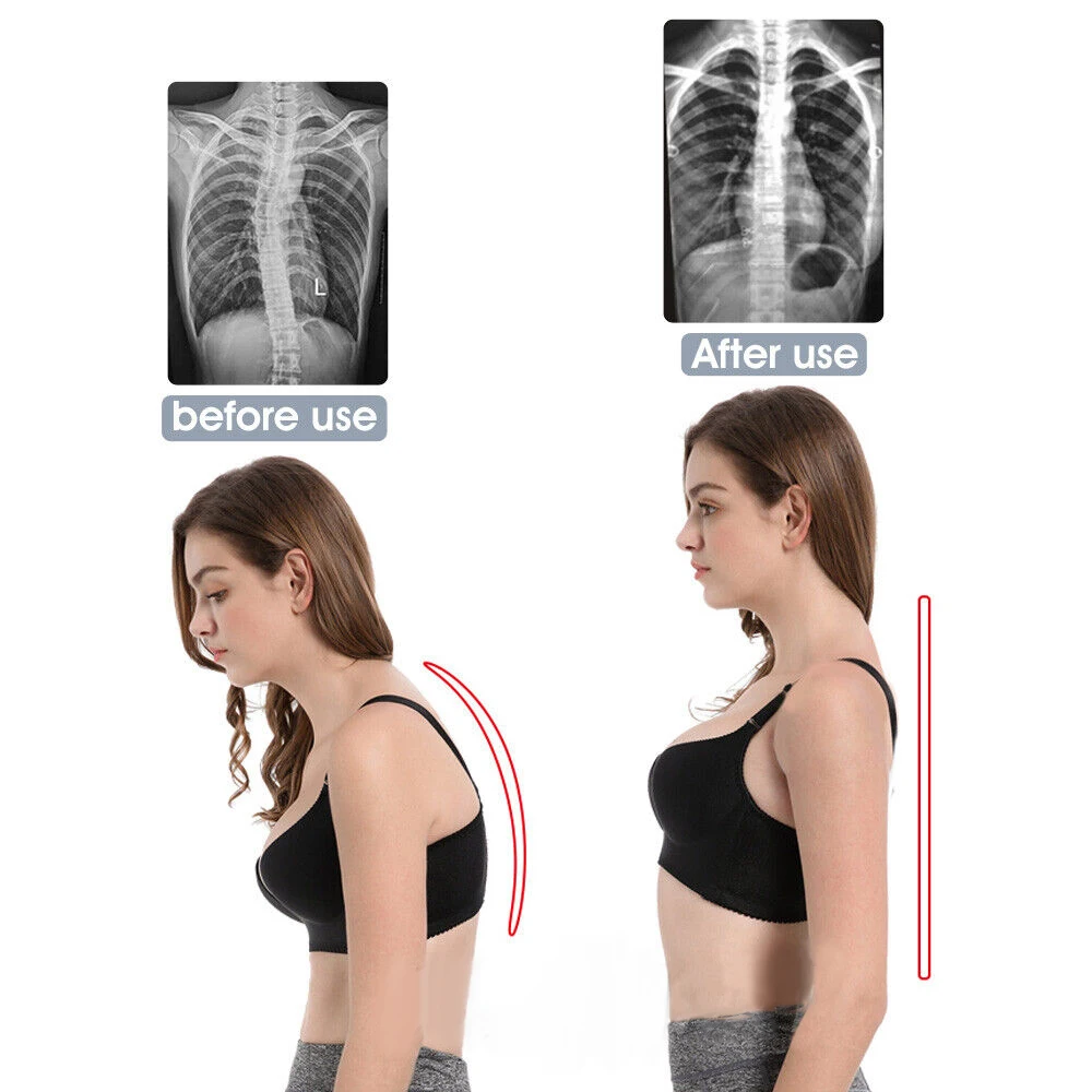 Posture Corrector Adjustable Shoulder Back Support Belt Straightener Brace Strap Office Use Pain Relief