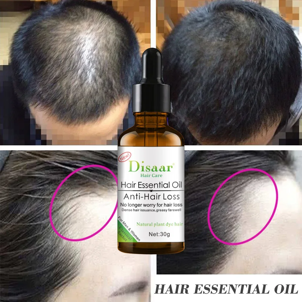 DISAAR Anti-Loss Product Hair Growth Natural Ginger Oil Rosemary Leaf Vitamin E Grape Seed Hair Oil Treatment BodyCare