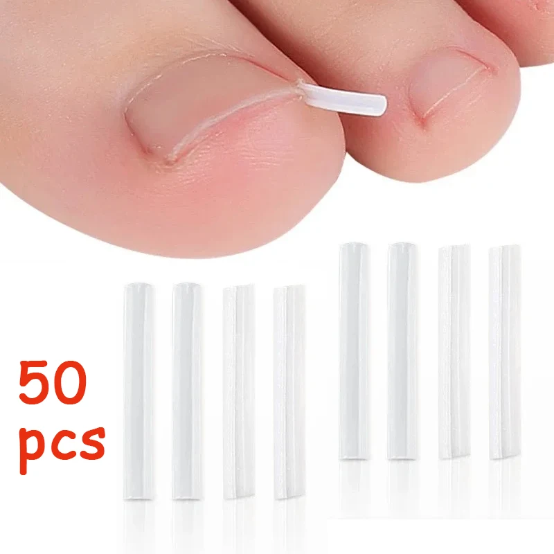 50Pcs Ingrown Toenail Correction Tool Invisible Ingrown Toe Nail Treatment Pad Groove Straightening Clip Brace Foot Care Tool