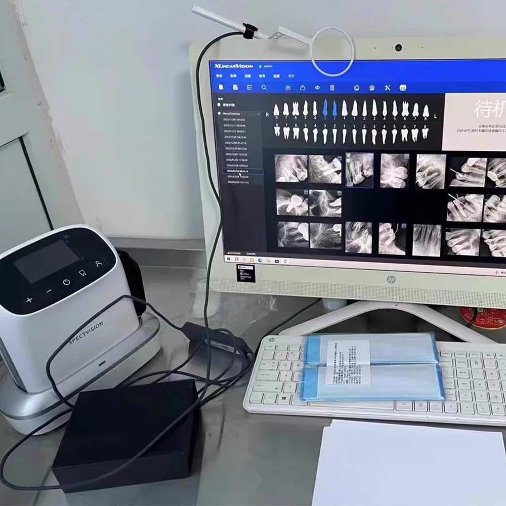 Dental X-ray Machine Oral Portable Handheld Dental Film Machine