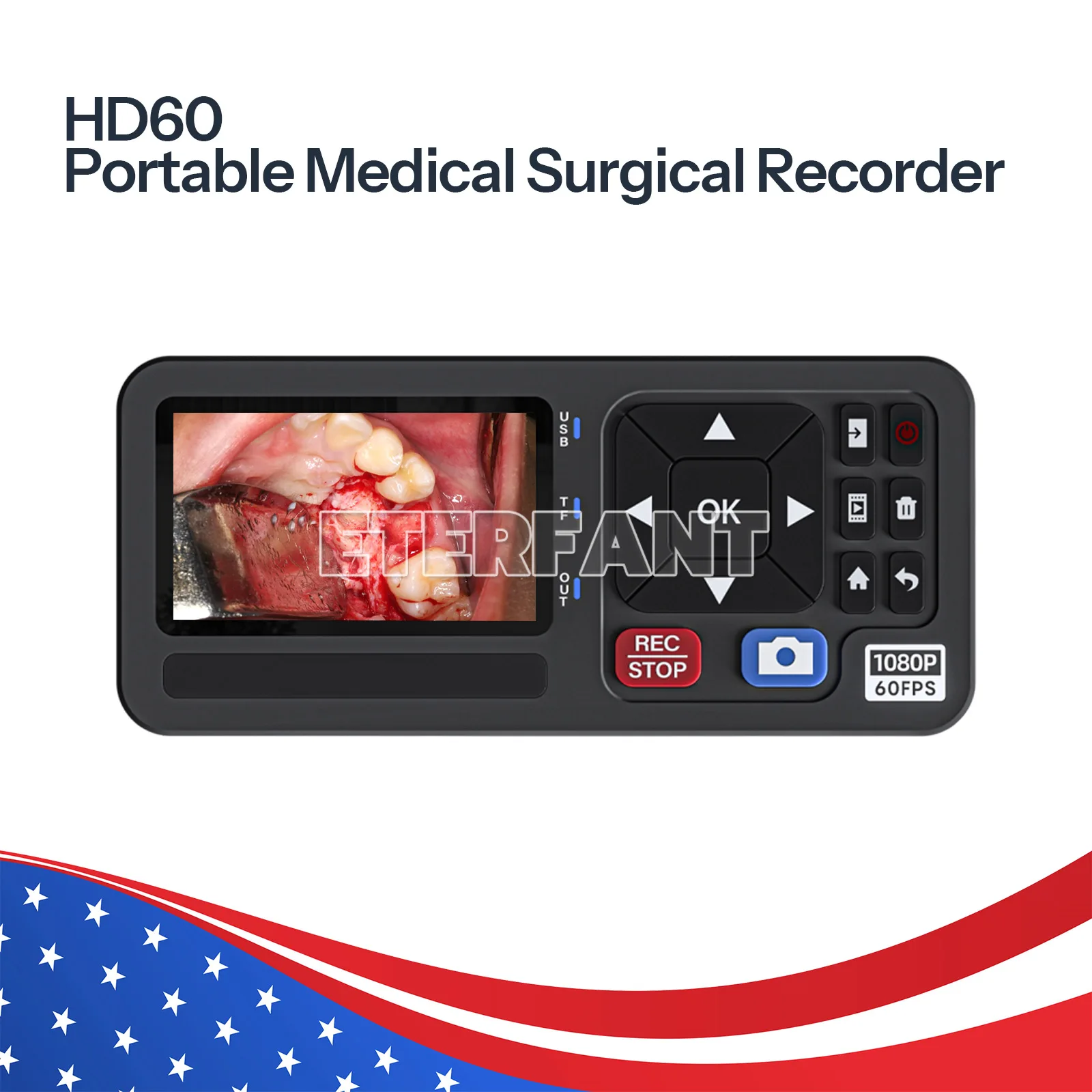 

ETERFANT Portable Medical Surgical Recorder for Laparoscopy and Endoscopy Capture HD60 Integrated Display Recording Capabilities