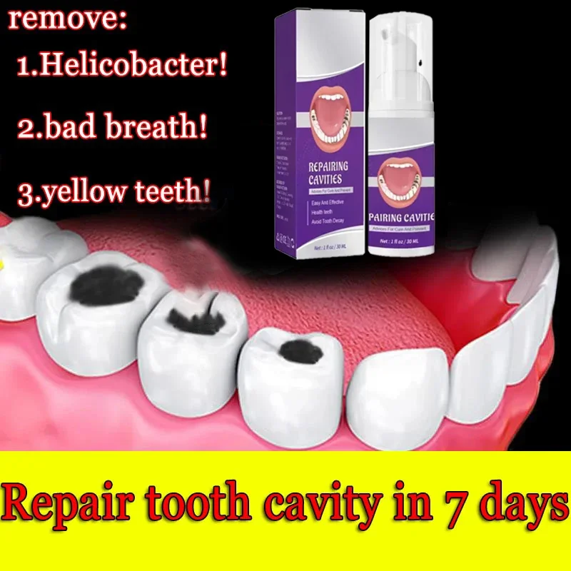 Hot sales Best-selling, Scientific Repairs Cavities, Removes Cavities, Cleans Plaque, Whitens Teeth, and Freshens Breath