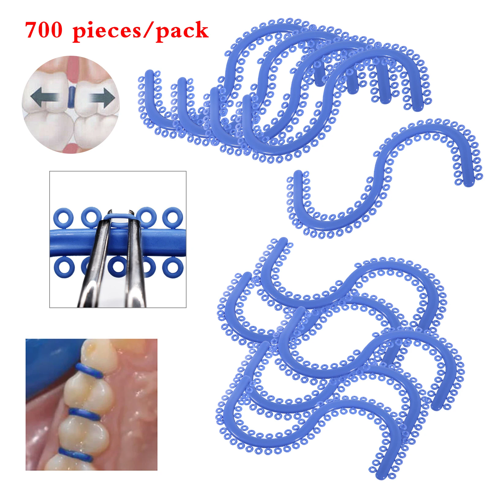 1 bag Dental Separate Teeth Dental Tool Orthodontic  Separator Tie Blue Color Spacers S shape