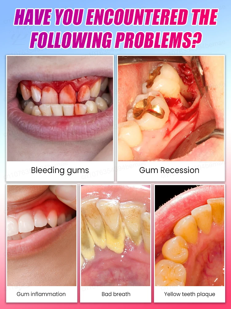 Promotes gum regeneration, provides long-lasting protection for dental health, and features the latest upgraded formula.