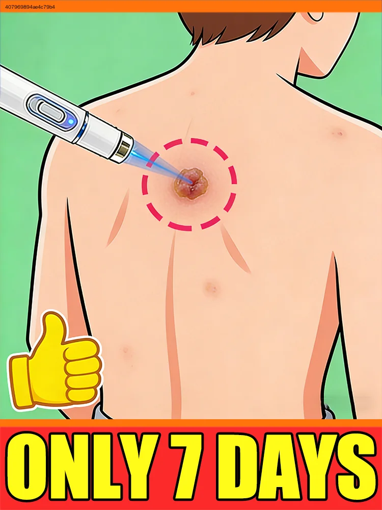 

Новейшие бестселлеры: Лазер 3-го поколения, избавляющий от бородавок за 7 дней