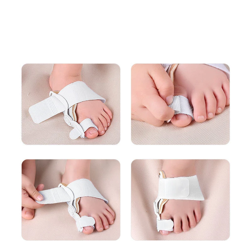 Toe Separator for Child Bunion Corrector Toe Orthopedic Straighteners Ajustável Bunion Splint com Correção de Botão