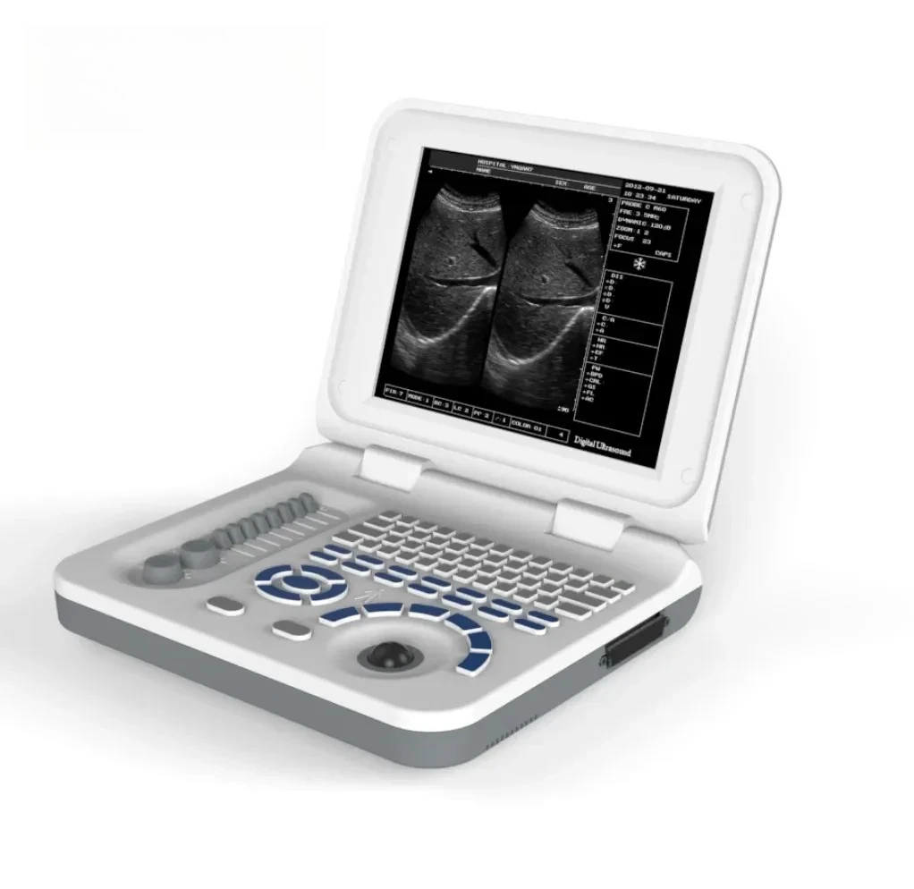 

veterinary ultrasound portable Black and white ultrasound scanner 10 inches