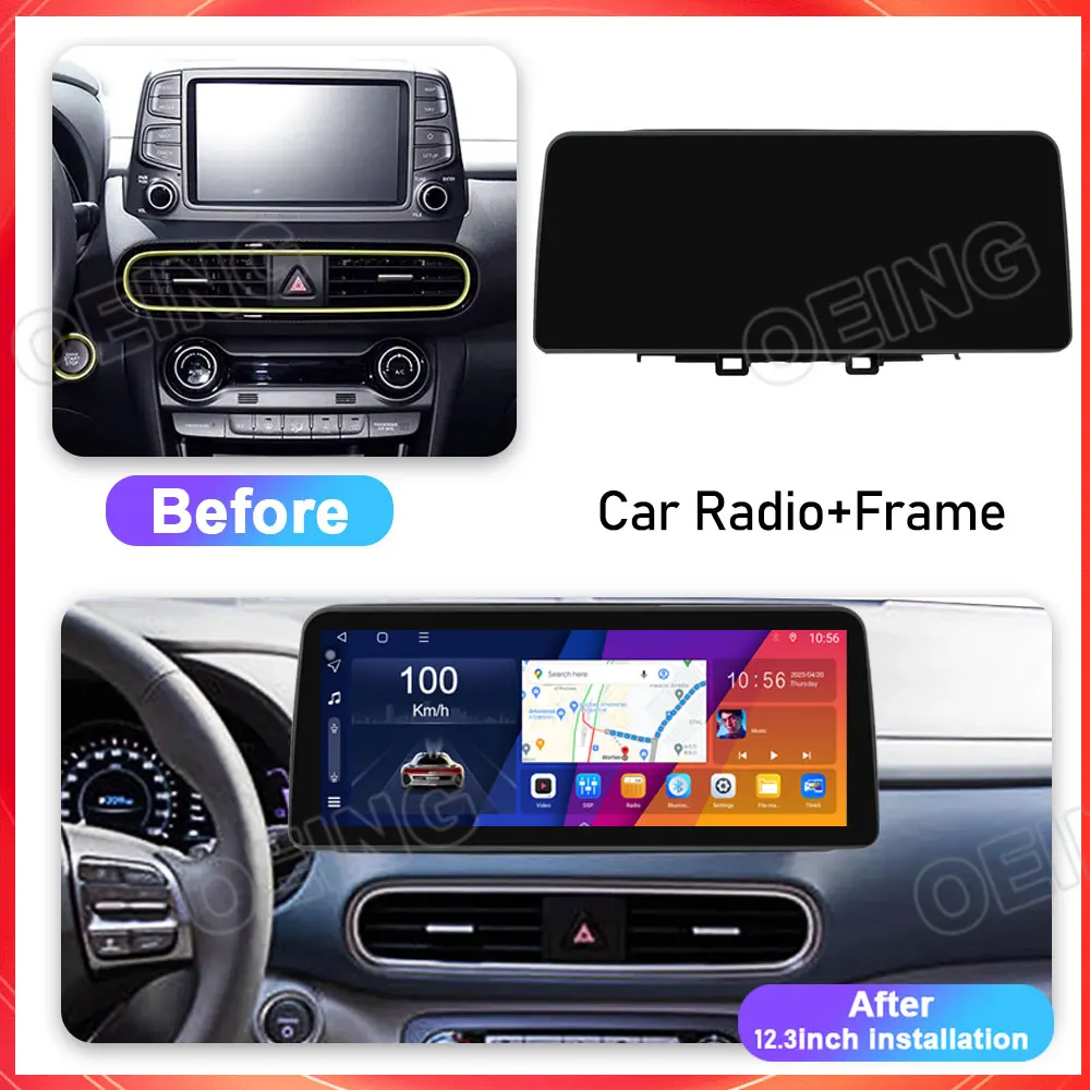 12.3\'\' QLED Screen Car Music Stereo For HYUNDAI KONA 2017 2018 2019 Android CarPlay Navigation Multimedia Video Player 128GB ROM