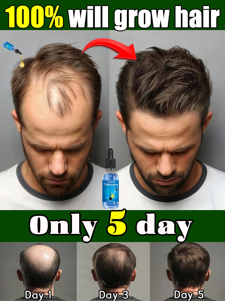 

2025, best-selling hair growth products, no more trouble with hair loss, fast hair growth hair care oil