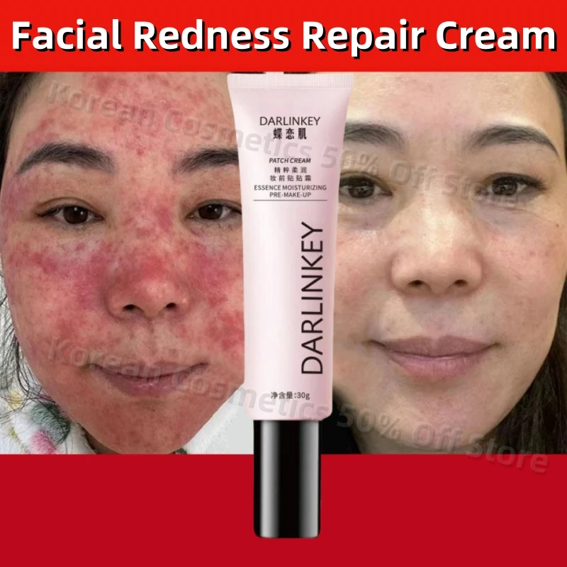 New Facial Redness Repair Cream Improve Rosacea Sooth Dry Sensitive Itchy Skin Repair Barrier Moisturize Lotion Korean Cosmetics