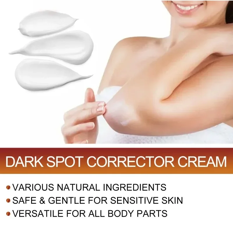 Sdotter New Body Whitening Cream Underarm Legs joint fade dark spots Knee Elbow Armpit Bleach Improve Dull Remove Melanin Bright