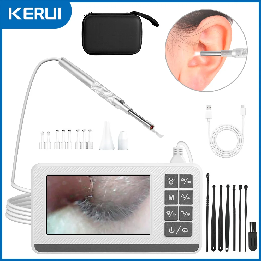 KERUI 3.9mm Otoscope Ear Endoscope Camera with 6 Lights 4.3 Inch Screen Ear Wax Removal Tool Earpicker for Kids Adults P60