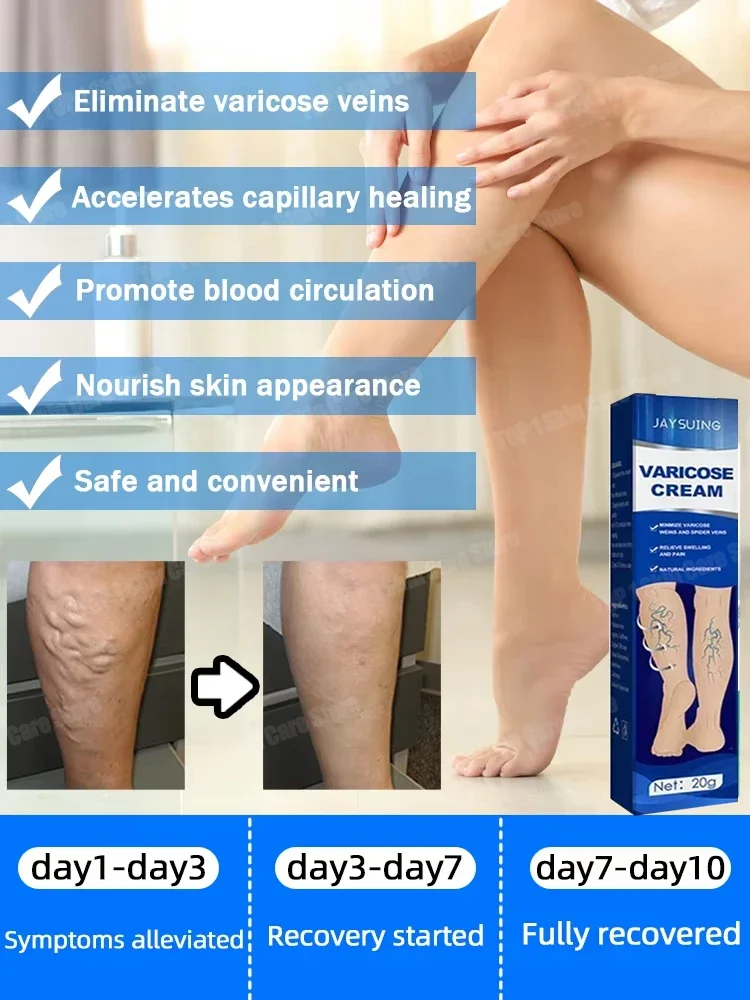 Vein bending cream, leg care, maximum strength, 100% organic and natural