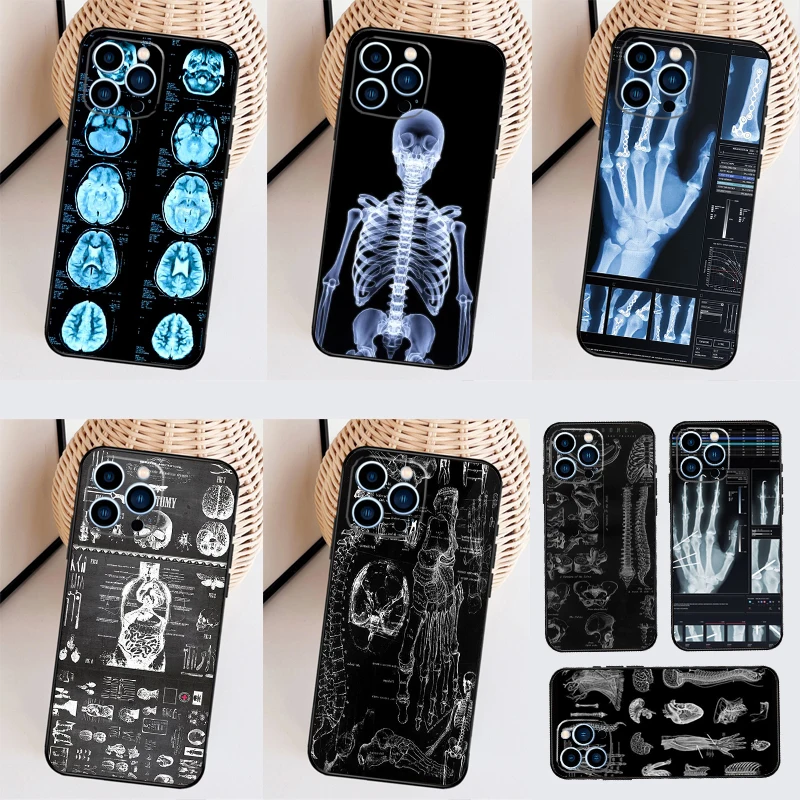 Radiological Human Organs Skeleton Cover Case For iPhone 14 Pro 11 16 15 Pro Max 12 13 Mini Plus XS X XR Funda