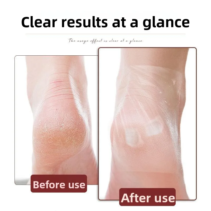 Disposable Transparent Self-Adhesive Foot Heel Protection Film Finger Crack Patch Anti-Dryness Wear-Resistant Shoe Cover