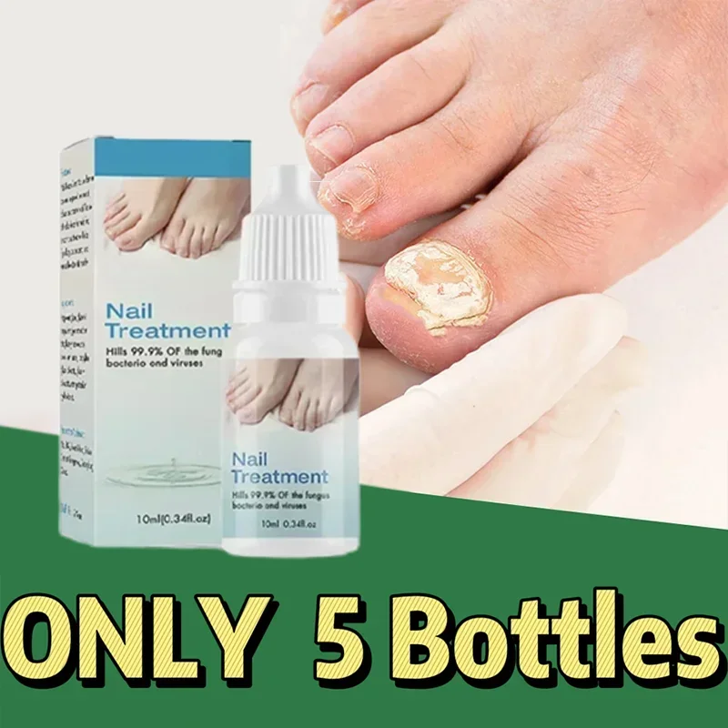 

Toenail Nail Fungus Treatment Repair Fingernail Device Toenail Treatment for Foot Nail Fungus Essential Oil Onychomycosis Care