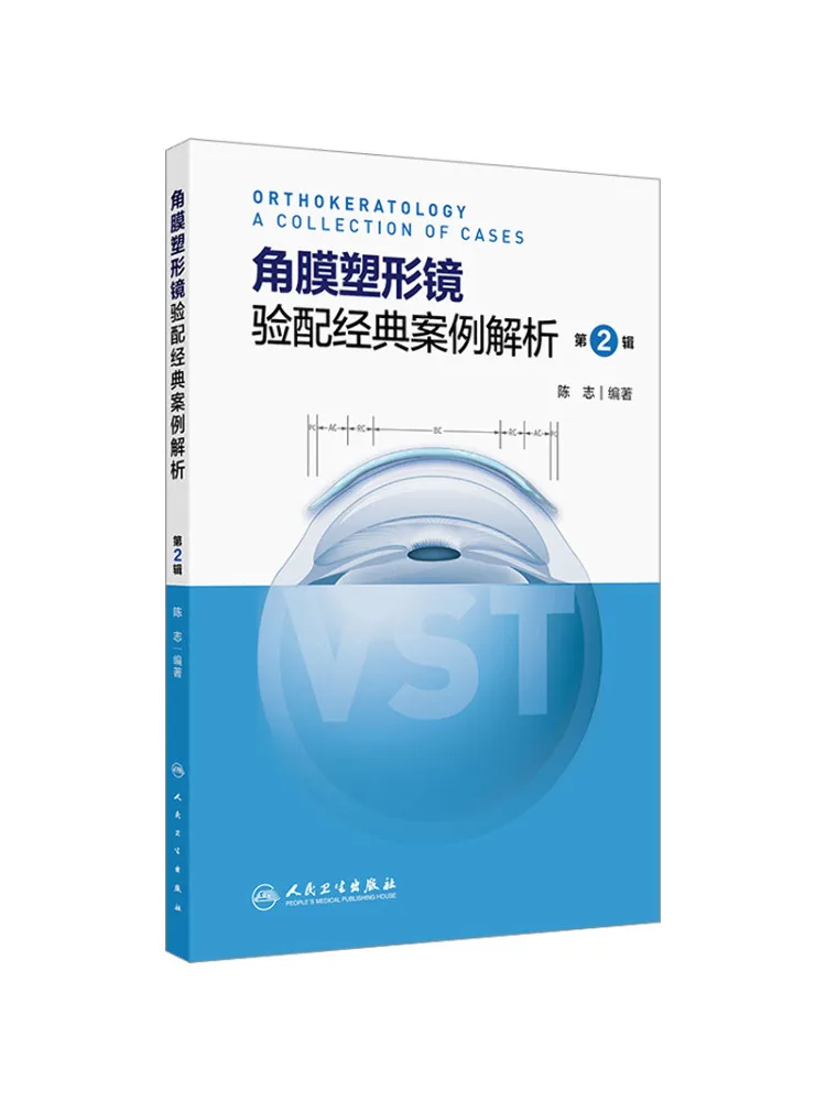 

Книга-Winshare Analysis классических футляров для угловой пленки, сборочная серия 2.