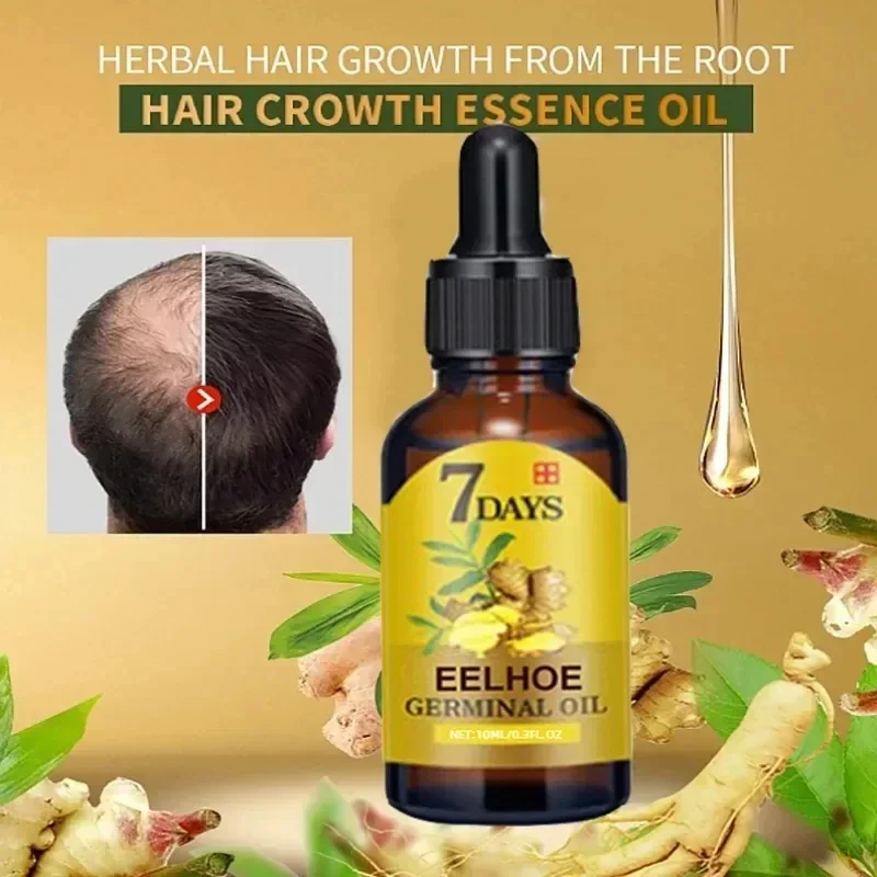 7 Day Fast Hair Growth Oil Ginger Growth Hair Treatment Anti Hair Loss Men Women Scalp Treatment Serum Products Beauty Product view 4