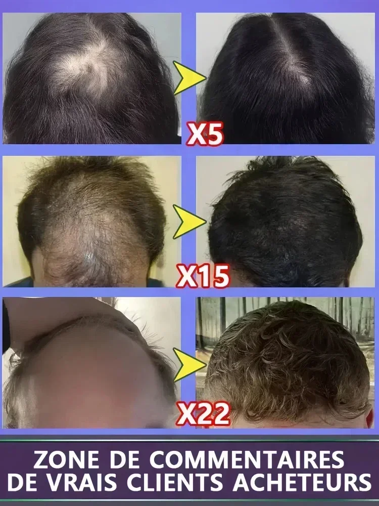 100% revive hair, strong penetration, activate hair roots, more hair, say goodbye to baldness, thick hair