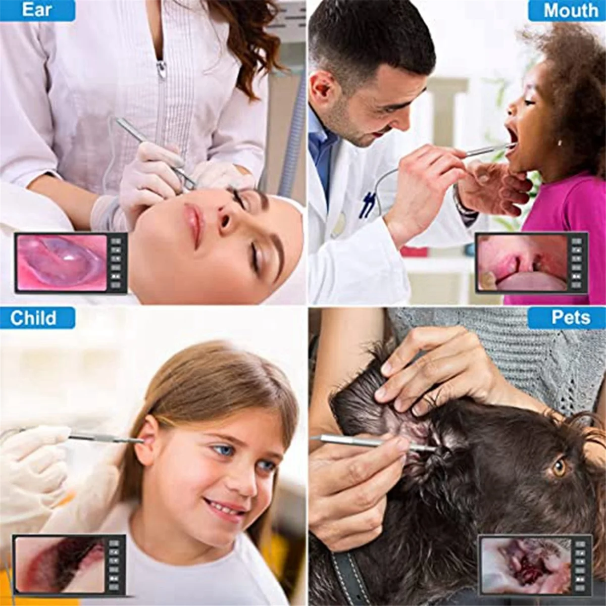 Otoscópio Digital com Tela de 7 ", Ear Scoop Visual, Câmera Orelha, Suporta Instantâneos Fotográficos e Gravação de Vídeo