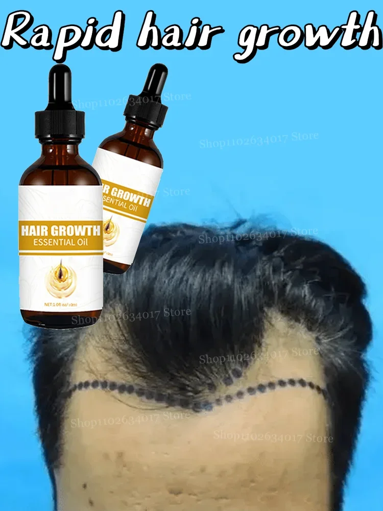 Encendi el potencial de crecimiento natural de tu cabello