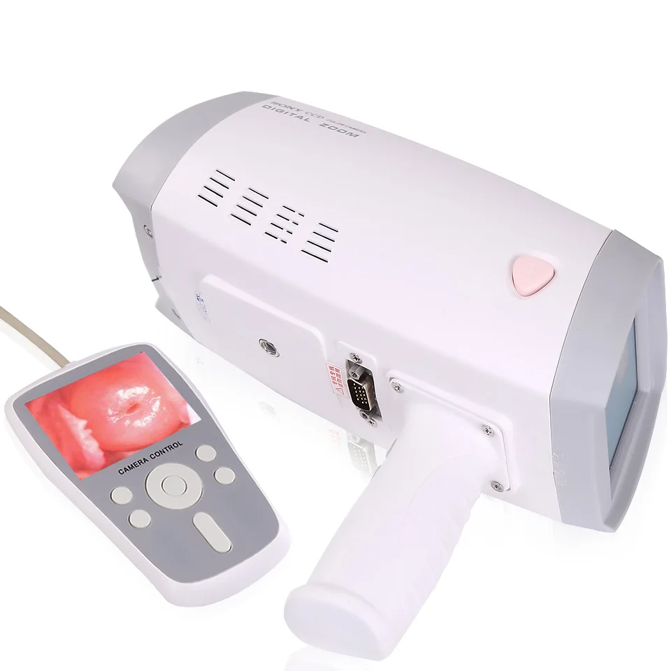 The most cost-effective HKN-2000 handheld digital gynecological video colposcopy for gynecology