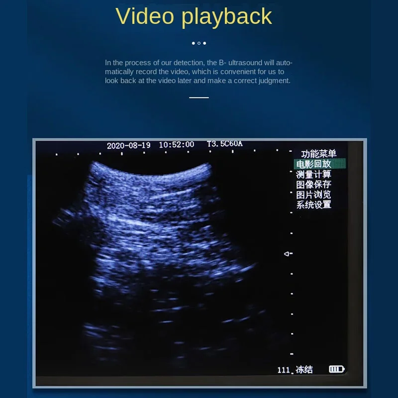 

Portable 5.6 Inch Screen Veterinary Ultrasound Scanner for Cow Pig Sheep Horse - Farm Pregnancy Testing Machine