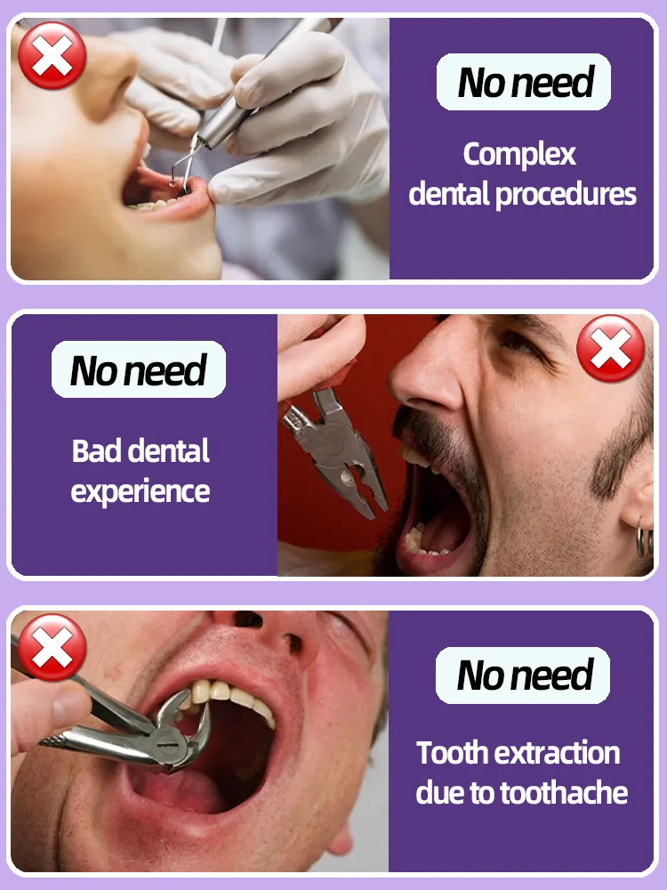 Repair Decay Cavities Anti Caries