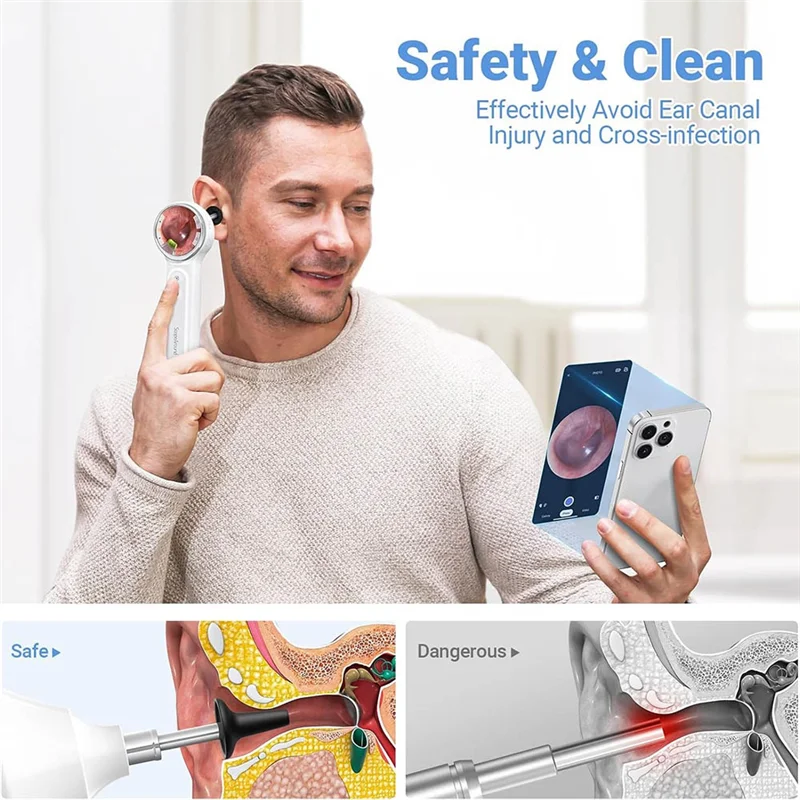 ABMF-ライト付きデジタル耳鏡、1.85インチIPSスクリーン、720P HD耳カメラ、耳垢除去ツール、ビデオ機能