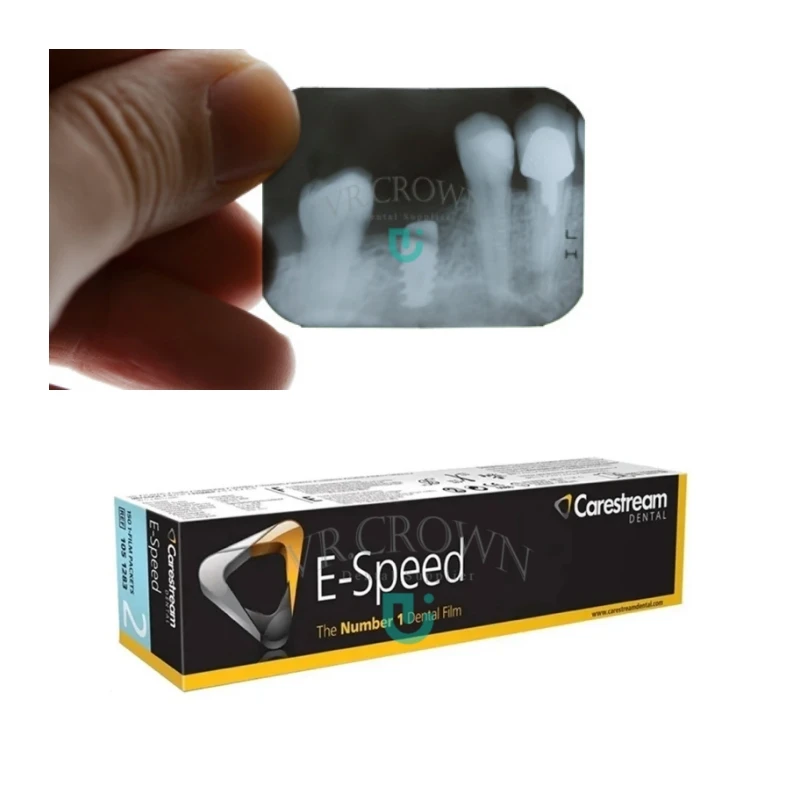 CareStream Speed E-Speed Wewnątrzustne filmy rentgenowskie Kodak Dental Use E Speed Filmy rentgenowskie Obrazowanie dla dorosłych