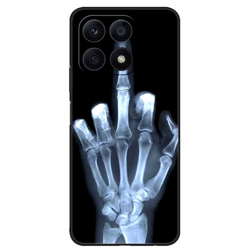 For Honor Play9A 2024 Case 6.56'' Cool Black Silicon Soft TPU Phone Cases for Honor Play 9A GFY-LX3 Back Cover Animals Wolf Lion
