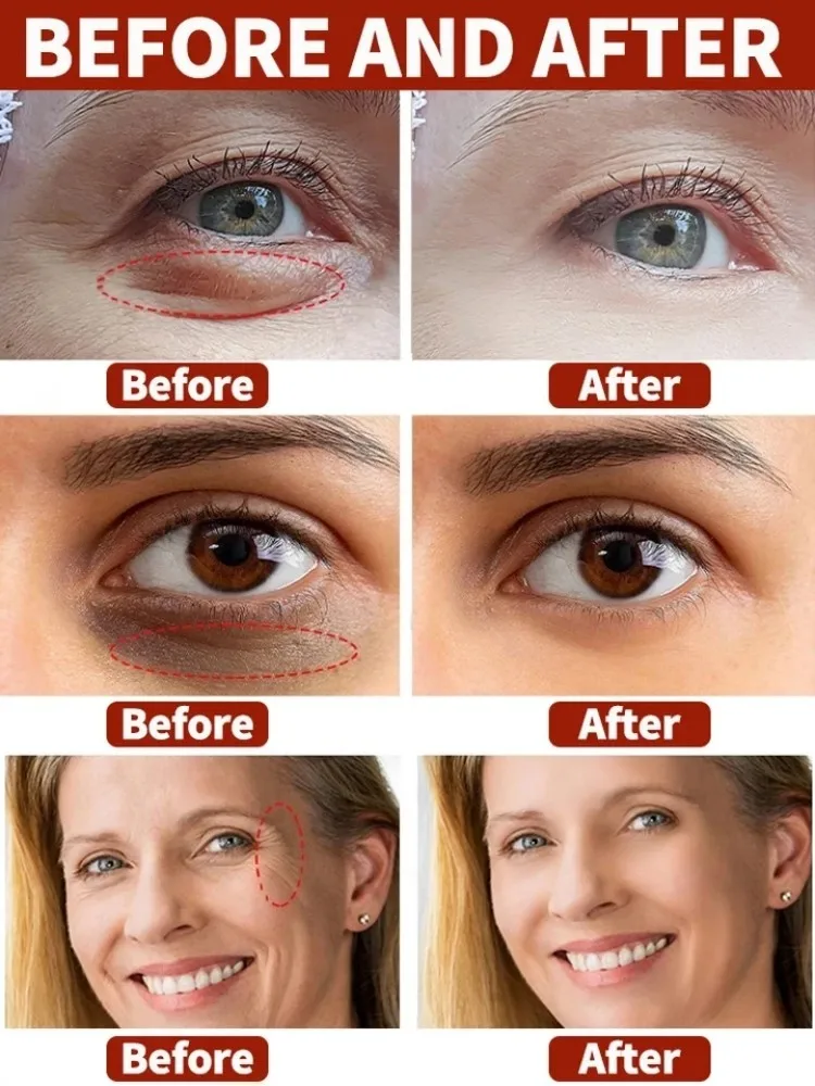 Crema Oxys antiarrugas, crema Facial antiarrugas, Estiramiento Facial antienvejecimiento, masajeadores faciales, producto para eliminar arrugas