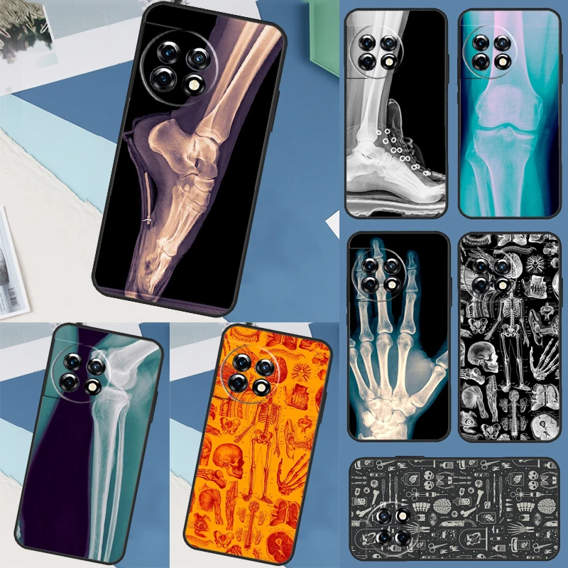 X-Ray Human Anatomy Case For OnePlus Nord 2T CE 2 3 Lite N20 N10 N100 OnePlus 11 8T 9R 10R 10T 9 10 Pro Cover