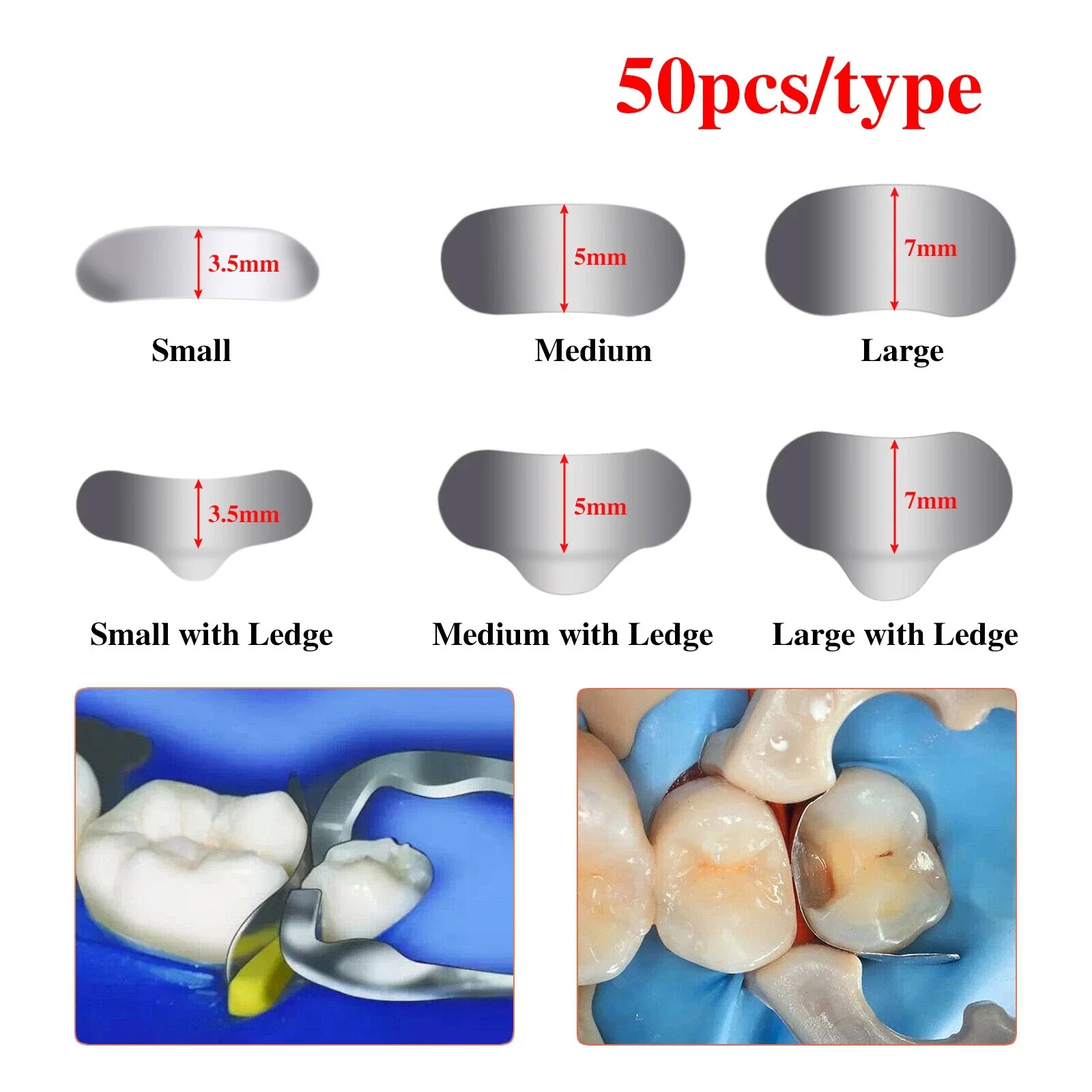 50PCS/1Box Dental Sectional Matrix System Contoured Metal Matrices Refill Matrix Bands