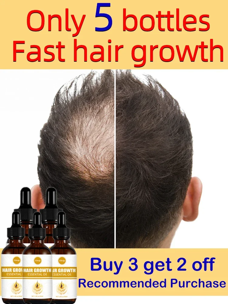 

O óleo de crescimento capilar faz o cabelo crescer rapidamente, repara eficazmente a calvície e a queda de cabelo hereditária