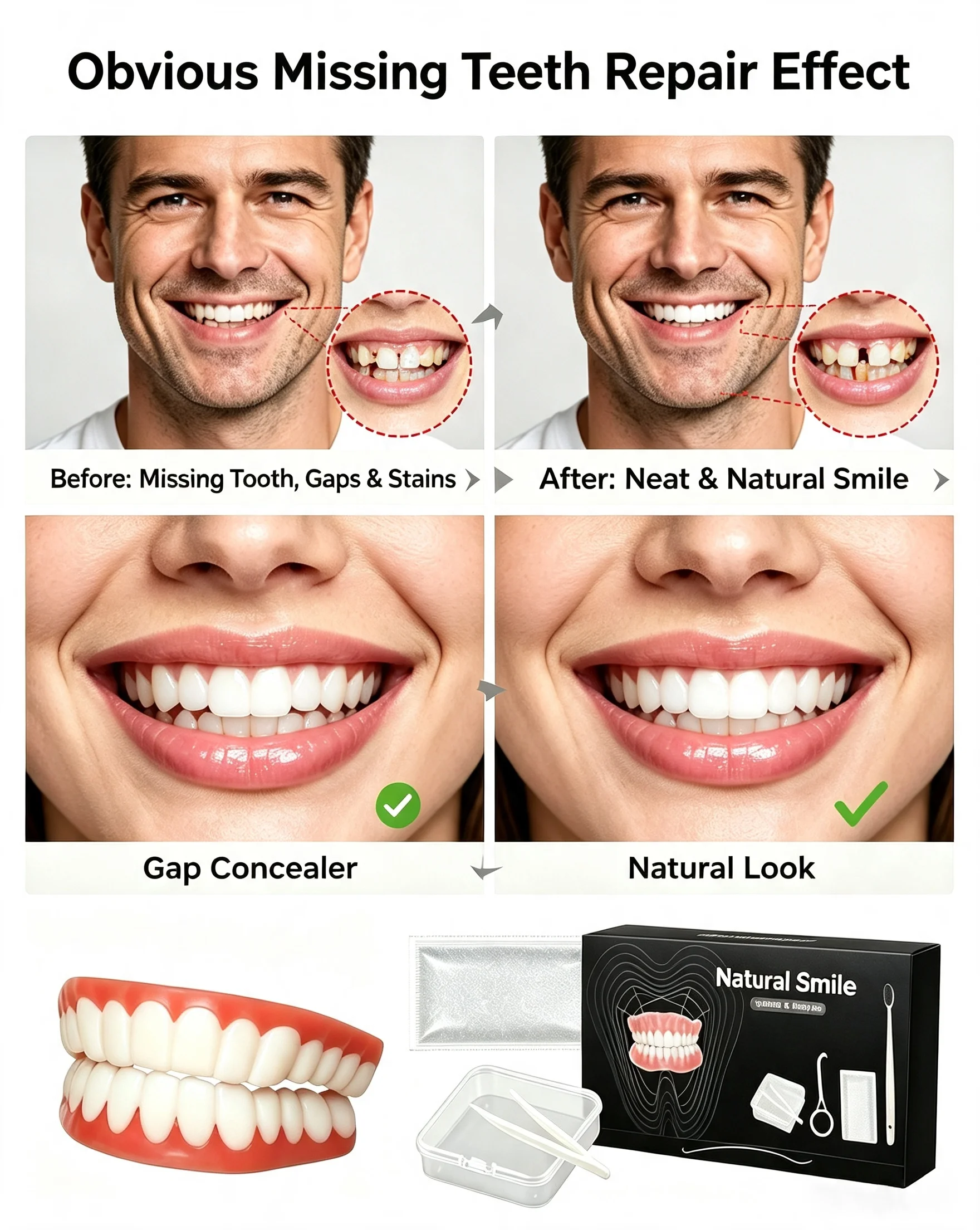 Simulation Temporary Denture, Tooth Gap Filler, Invisible Aesthetic Portable Instant Smile Aligner