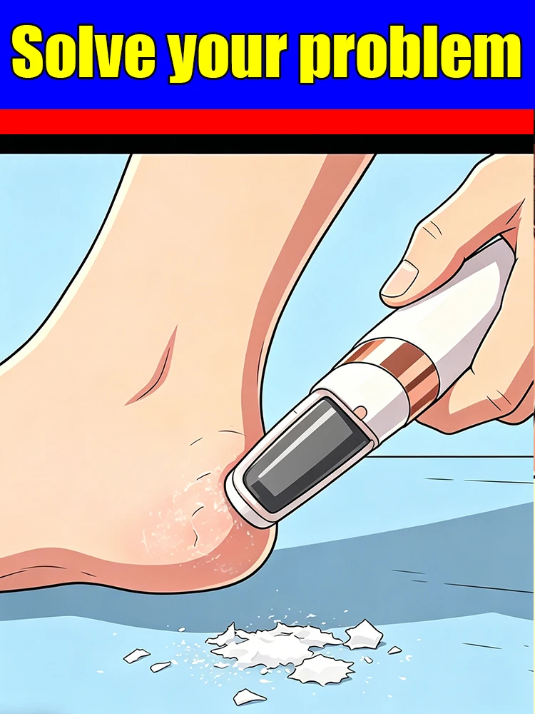 novos-produtos-2026-ferramentas-de-pedicure-mais-populares-e-diga-adeus-aos-calos