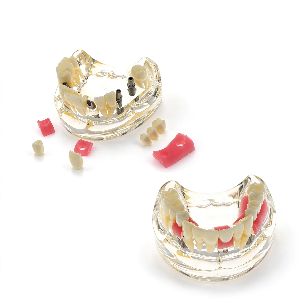 Dental Tooth Model Dental Implant Model Removable Teeth Dentistry Demonstrates Implant Crowns Bridge Models For Studying Demo