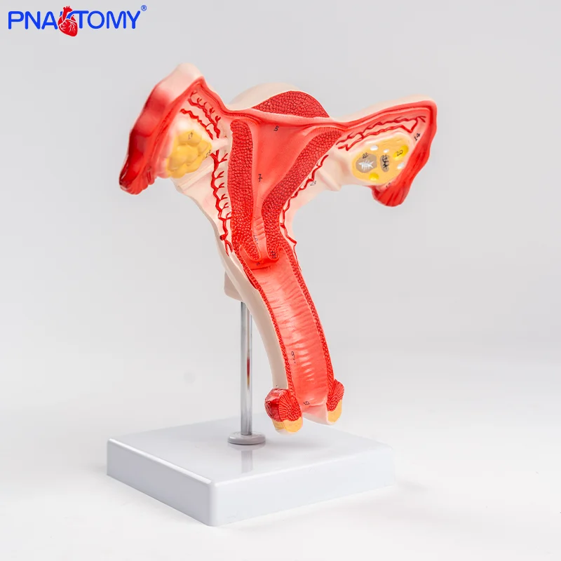 

Female internal reproductive organ uterine model reproductive structure gynecological model uterine anatomical model