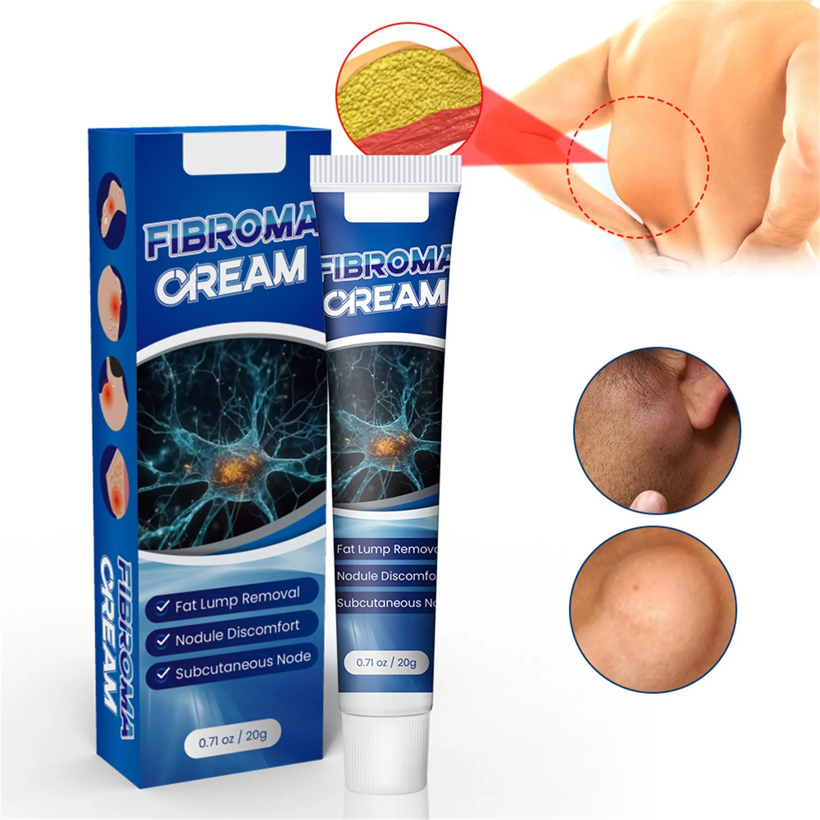 Reduce Lipoma, Moisturizing Effect, Reduce Lipoma Gel In Organic Material With Fast Absorption, Reduction Of Inflammation