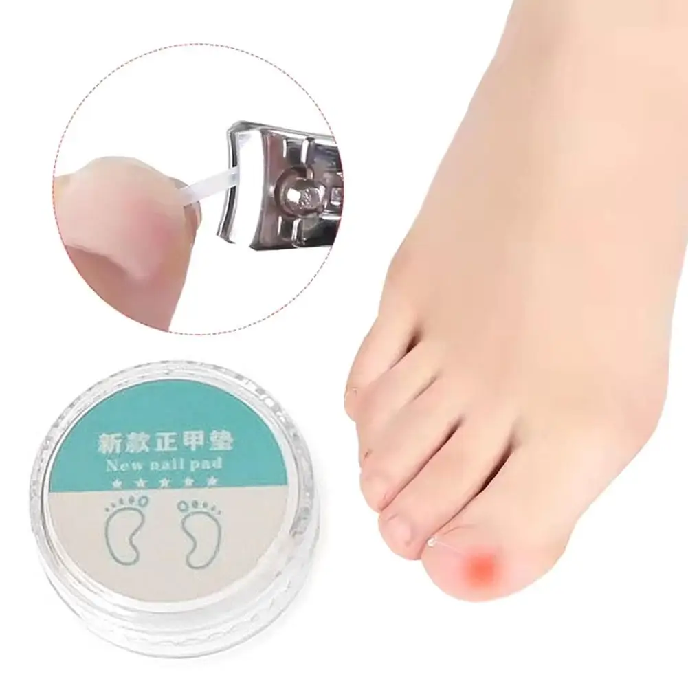 1Set Ingrown Toenai…