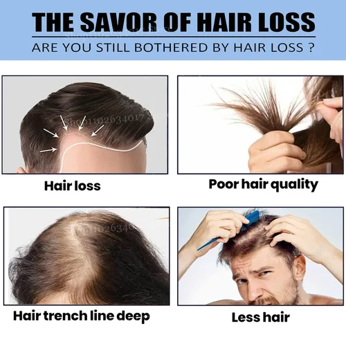 Imagen 2 del producto Awaken Dormant Follicles for Abundant Hair