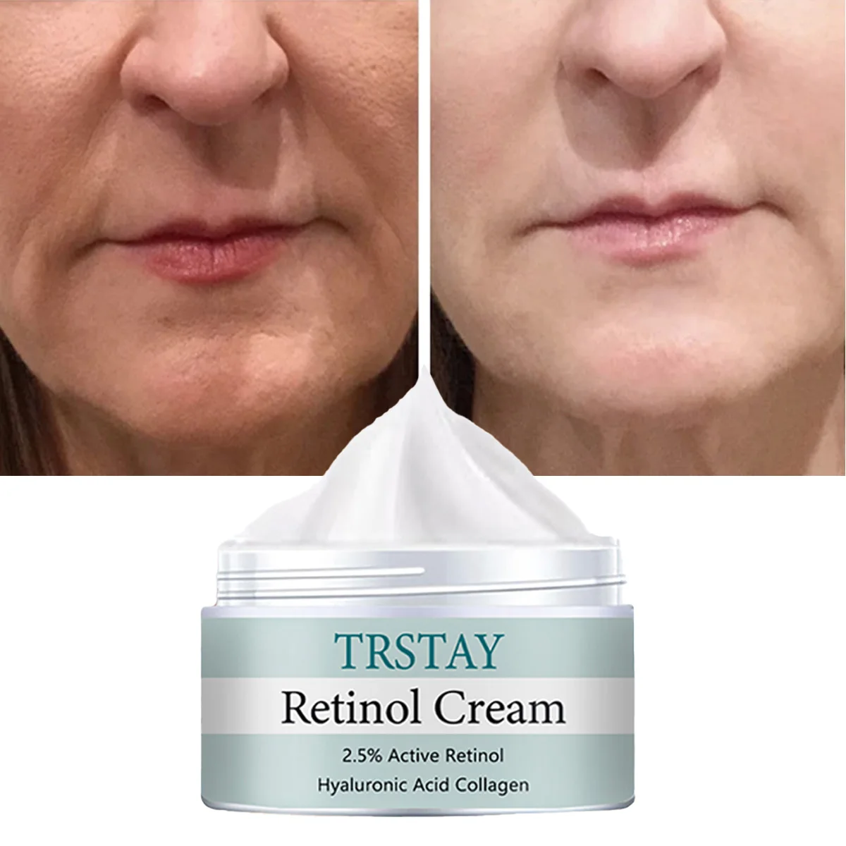 TRSTAY Retinol Cream 2.5% Active Retinoid Hyaluronic Acid Collagen Facial Moisturizer Anti-Aging Wrinkle Reduction Whitening