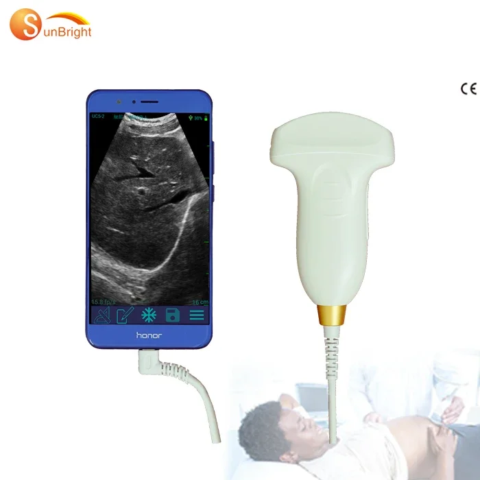 

Hot Sale Convex Probe USB Portable Ultrasound