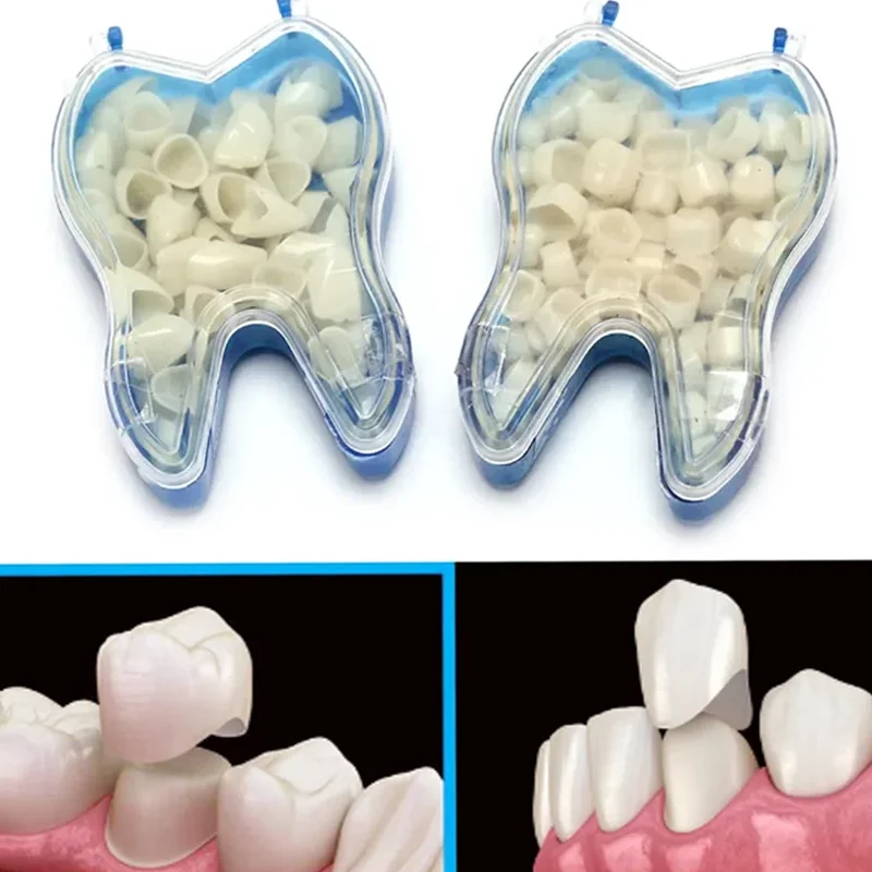 

50/100 шт., виниры для отбеливания зубов