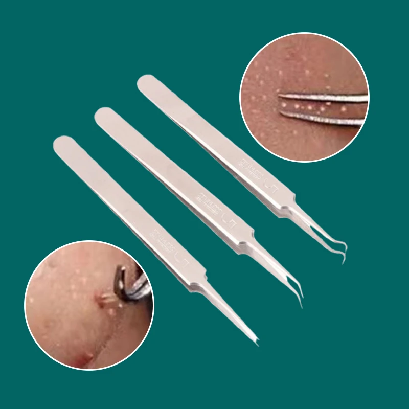 Pince à épiler Ultra-fine pour boutons de cellules, dissolvant de points noirs, aiguille d'acné, nettoyeur en profondeur de points noirs, outil de soins de la peau du visage