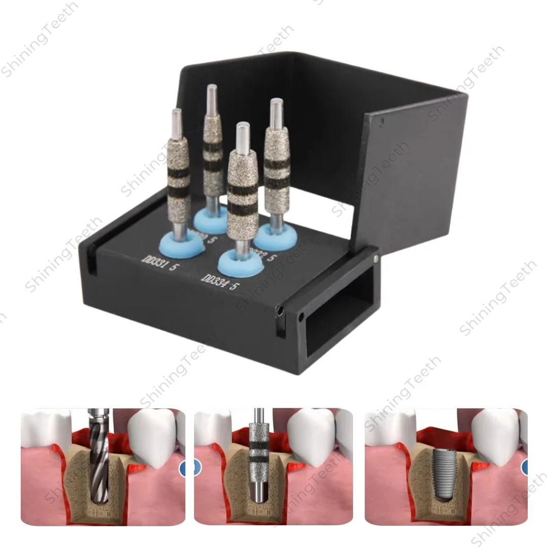 

Dental Implant Drill Kit for Bone Track Guided Neck Correction Diamond Coated Cutting Grinding Drills for Jawbone Surgery