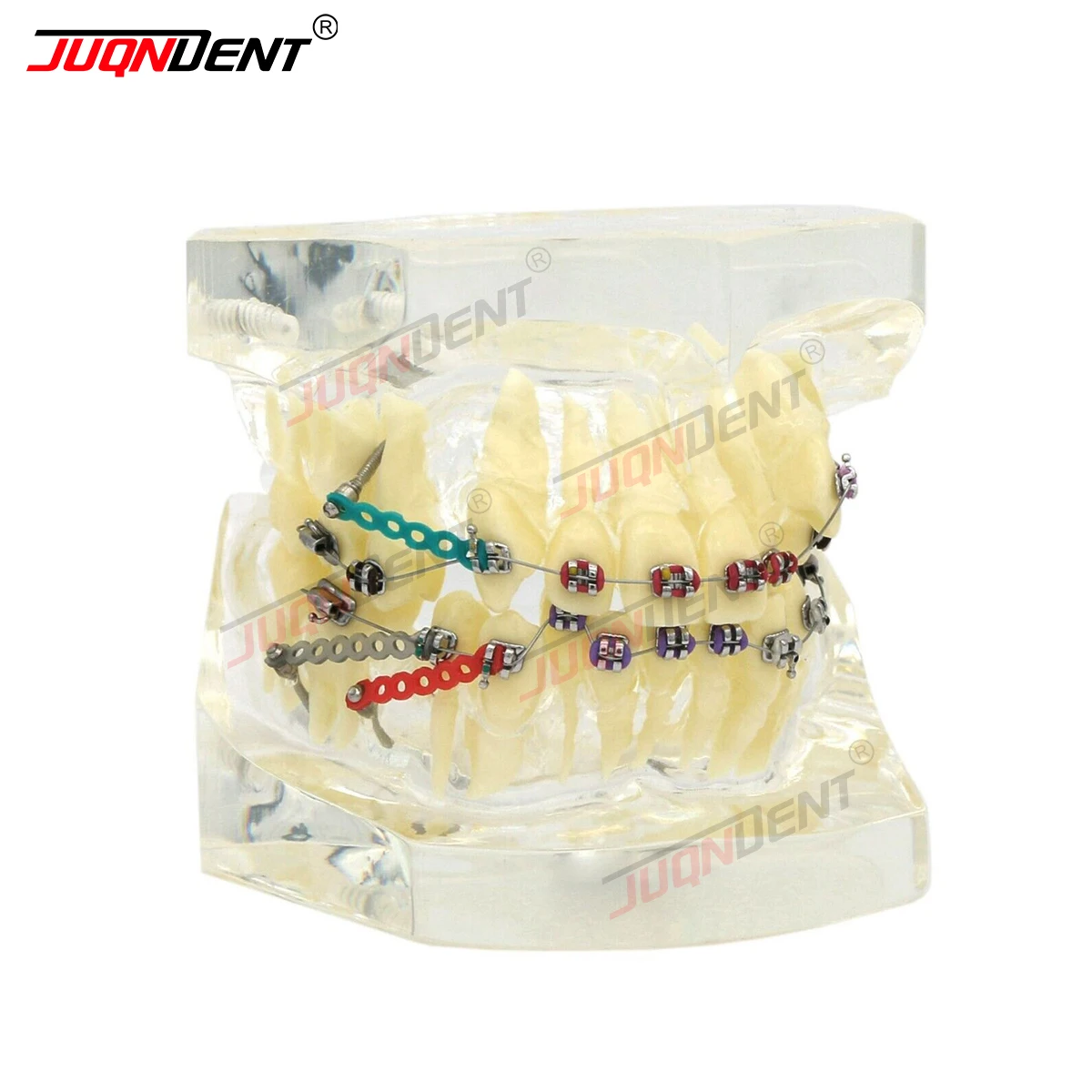 Dentel Model Dental Orthodontic Demonstration Practice Model Treatment Malocclusion With Brackets Chain Wire SG