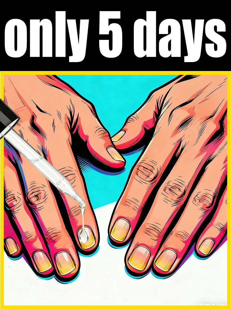 Eʟɪᴍɪɴᴀᴛᴇ ғᴜɴɢᴀʟ ɴᴀɪʟs Rapid penetration, restoring nails to their natural shine. Say goodbye to fungal nails